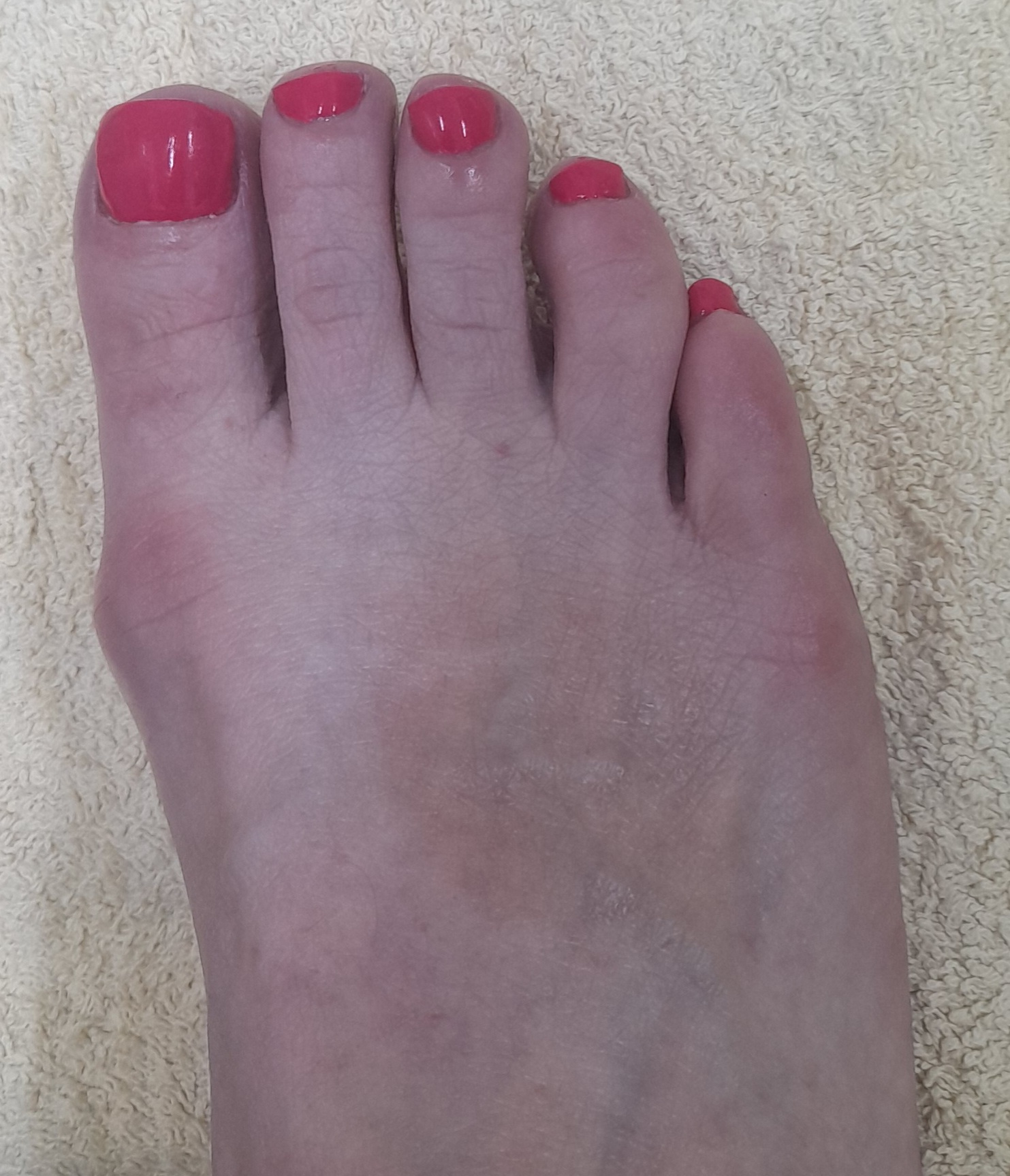 A finished pink pedicure at Beauty Within